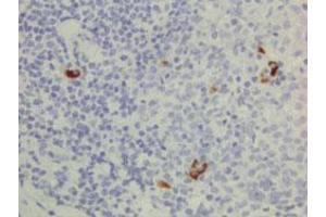 Immunohistochemical staining (Formalin-fixed paraffin-embedded sections) of human lymphoid tissue with Human IgG3 monoclonal antibody, clone RM119 (Biotin) .