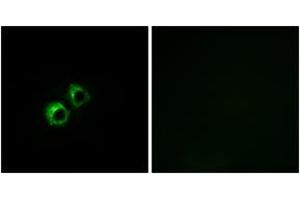 Immunofluorescence analysis of MCF7 cells, using MRPS21 Antibody. (MRPS21 Antikörper  (AA 38-87))