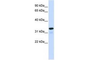 Image no. 1 for anti-Nuclear Factor of kappa Light Polypeptide Gene Enhancer in B-Cells Inhibitor, alpha (NFKBIA) (C-Term) antibody (ABIN6744364) (NFKBIA Antikörper  (C-Term))