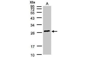 WB Image Sample(30 μg of whole cell lysate) A:Hep G2, 12% SDS PAGE antibody diluted at 1:3000 (GSTa2 Antikörper)