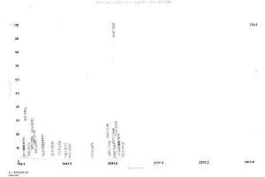 Image no. 3 for Calreticulin (CALR) peptide (Ovalbumin) (ABIN5666115) (Calreticulin (CALR) peptide (Ovalbumin))