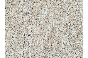 Immunohistochemistry analysis using Rabbit Anti-ATG10 Polyclonal Antibody (ABIN5065887). (ATG7 Antikörper  (N-Term) (Atto 488))