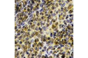 Immunohistochemical analysis of BTK staining in human spleen formalin fixed paraffin embedded tissue section.