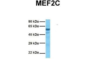 Host:  Rabbit  Target Name:  MEF2C  Sample Tissue:  Human Fetal Brain  Antibody Dilution:  1. (MEF2C Antikörper  (N-Term))