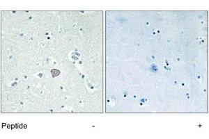 Immunohistochemistry analysis of paraffin-embedded human brain tissue using ADORA2A polyclonal antibody . (Adenosine A2a Receptor Antikörper)