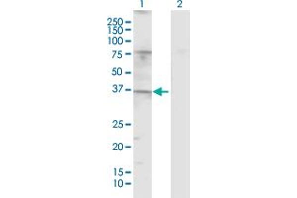TAS2R20 Antikörper  (AA 1-309)