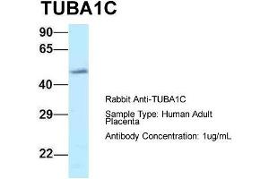 Host: Rabbit  Target Name: TUBA1C  Sample Tissue: Human Adult Placenta  Antibody Dilution: 1.