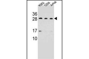 CD79A Antibody (C-term) (ABIN656983 and ABIN2846166) western blot analysis in K562,CEM,Jurkat cell line lysates (35 μg/lane). (CD79a Antikörper  (C-Term))