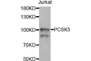 Western blot analysis of extracts of jurkat cells, using PCSK5 antibody. (PCSK5 Antikörper)