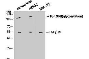 Western Blot analysis of various cells using TGF β Receptor II Polyclonal Antibody at dilution of 1:1000. (TGFBR2 Antikörper)