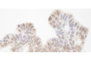 Immunohistochemistry (IHC) image for anti-SIN3 homolog A, transcription regulator (SIN3A) (AA 1-50) antibody (ABIN7448796) (SIN3A Antikörper  (AA 1-50))