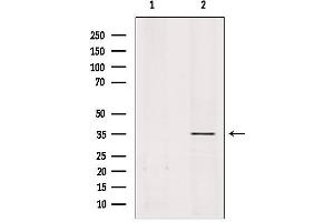 Western blot analysis of extracts from rat brain, using OR51A1P Antibody. (OR51A1P Antikörper)