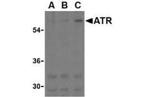 Western blot analysis of ATR in K562 cell lysates with this product atR antibody at (A) 0. (ANTXR1 Antikörper  (C-Term))
