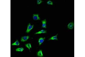 Immunofluorescence staining of A549 cells with ABIN7169583 at 1:100, counter-stained with DAPI. (CD164 Antikörper  (AA 24-162))