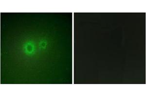 Immunofluorescence analysis of HUVEC cells, using LRAT antibody. (LRAT Antikörper  (Internal Region))