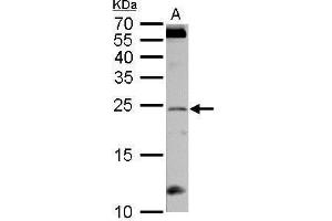 WB Image RGS4 antibody detects RGS4 protein by Western blot analysis.