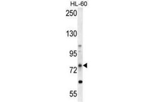 ABCD1 Antibody (Center) western blot analysis in HL-60 cell line lysates (35 µg/lane). (ABCD1 Antikörper  (Middle Region))