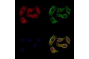 Phospho-SCD1 (Tyr55) Antibody staining Hela cells(heat shock treatment) by IF/ICC. (SCD Antikörper  (pTyr55))