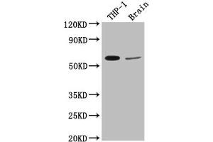 Western Blot Positive WB detected in: THP-1 whole cell lysate, Rat brain tissue All lanes: COL9A2 antibody at 1:2000 Secondary Goat polyclonal to rabbit IgG at 1/50000 dilution Predicted band size: 66 kDa Observed band size: 66 kDa (Collagen Type IX alpha 2 (COL9A2) (AA 594-611) Antikörper)