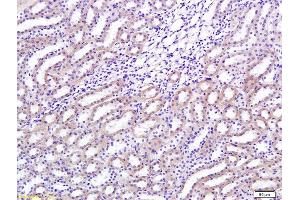 Formalin-fixed and paraffin embedded rat renal tissue labeled with Anti-TGF-beta-1 Polyclonal Antibody, Unconjugated (ABIN724685) 1:200 followed by conjugation to the secondary antibody and DAB staining (TGFB1 Antikörper  (AA 351-390))