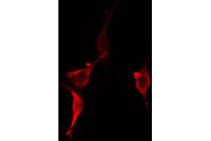 ABIN6274925 staining RAW264. (BAIAP2L2 Antikörper  (Internal Region))