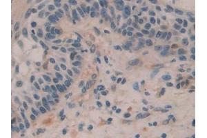 Immunohistochemistry (IHC) image for anti-H2A Histone Family, Member Y (H2AFY) (AA 109-369) antibody (ABIN7439753)