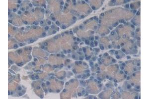 Detection of 15-LO-2 in Rat Pancreas Tissue using Polyclonal Antibody to 15-Lipoxygenase-2 (15-LO-2) (ALOX15B Antikörper  (AA 349-633))