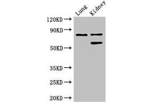 Western Blot Positive WB detected in: Mouse lung tissue, Mouse kidney tissue All lanes: LEPREL1 antibody at 3 μg/mL Secondary Goat polyclonal to rabbit IgG at 1/50000 dilution Predicted band size: 81, 61 kDa Observed band size: 81, 61 kDa (LEPREL1 Antikörper  (AA 301-528))