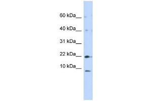 NDUFC2 antibody used at 1 ug/ml to detect target protein. (NDUFC2 Antikörper)