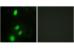 Immunofluorescence analysis of HeLa cells, using ETV6 Antibody. (ETV6 Antikörper  (AA 371-420))