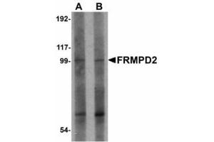 Image no. 1 for anti-FERM and PDZ Domain Containing 2 (FRMPD2) (N-Term) antibody (ABIN478186) (FRMPD2 Antikörper  (N-Term))