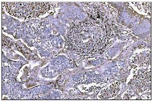 IHC analysis of NDEL1 using anti-NDEL1 antibody (ABIN7602511). (NDEL1 Antikörper  (AA 80-320))