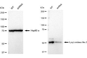 Western blotting analysis using Lysyl oxidase like 2 antibody (ABIN7799312). (Rekombinanter LOXL2 Antikörper)