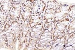 Immunohistochemistry analysis of paraffin-embedded mouse colon using,TORC1 (ABIN7073590) at dilution of 1: 800