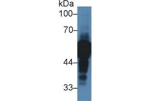 Western Blot; Sample: Human Lung lysate; Primary Ab: 2µg/ml Rabbit Anti-Human aHSG Antibody Second Ab: 0. (Fetuin A Antikörper  (AA 19-300))