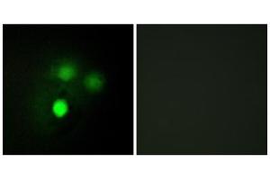 Immunofluorescence analysis of HUVEC cells, using KNTC2 antibody. (NDC80 Antikörper  (Internal Region))