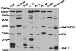 Western Blotting (WB) image for anti-Myelin Basic Protein (MBP) antibody (ABIN1873655)