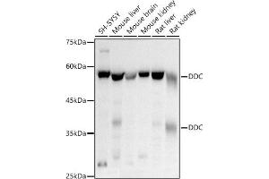 Western blot analysis of extracts of various cell lines, using DDC antibody (ABIN1679510, ABIN3018150, ABIN3018151 and ABIN6220384) at 1:500 dilution. (DDC Antikörper  (AA 1-100))