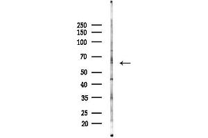 anti-Cytochrome P450 4A11/22 antibody
