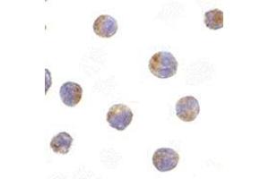 Immunocytochemistry of TIRP in Raji cells with this product at 10 μg/ml. (TICAM2 Antikörper  (C-Term))