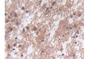 Immunohistochemistry (IHC) image for anti-Matrix Metallopeptidase 23B (MMP23B) (AA 79-390) antibody (ABIN7431308)