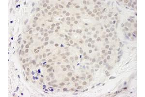 anti-DEAD (Asp-Glu-Ala-Asp) Box Polypeptide 23 (DDX23) (AA 1-50) antibody