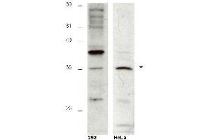 Western blot using  affinity purified anti-Hus1B antibody shows detection of a 36kDa band corresponding to Hus1B in a HeLa cell lysate (arrowhead).