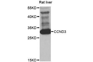 Western blot analysis of extracts of rat liver, using CCND3 antibody (ABIN5970442) at 1/1000 dilution. (Cyclin D3 Antikörper)