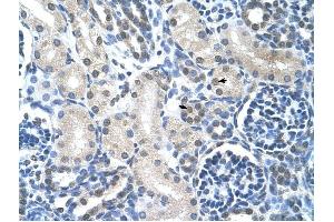 Loricrin antibody was used for immunohistochemistry at a concentration of 4-8 ug/ml to stain Epithelial cells of renal tubule (arrows) in Human Kidney. (LOR Antikörper  (N-Term))