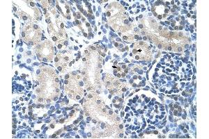Loricrin antibody was used for immunohistochemistry at a concentration of 4-8 ug/ml to stain Epithelial cells of renal tubule (arrows) in Human Kidney.