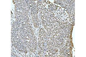 IHC analysis of 53BP1/TP53BP1 using anti-53BP1/TP53BP1 antibody (ABIN7599869). (TP53BP1 Antikörper  (AA 1239-1972))