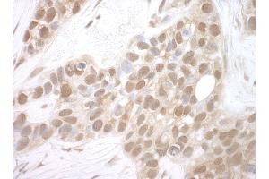 anti-BRISC and BRCA1 A Complex Member 1 (BABAM1) (AA 175-225) antibody