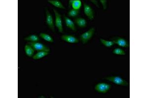 Immunofluorescent analysis of A549 cells using ABIN7163798 at dilution of 1:100 and Alexa Fluor 488-congugated AffiniPure Goat Anti-Rabbit IgG(H+L) (PCGF2 Antikörper  (AA 103-316))