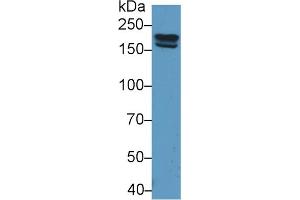 Detection of PZP in Rat Serum using Polyclonal Antibody to Pregnancy Zone Protein (PZP) (PZP Antikörper  (AA 1251-1500))